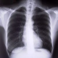 x-ray x-ray